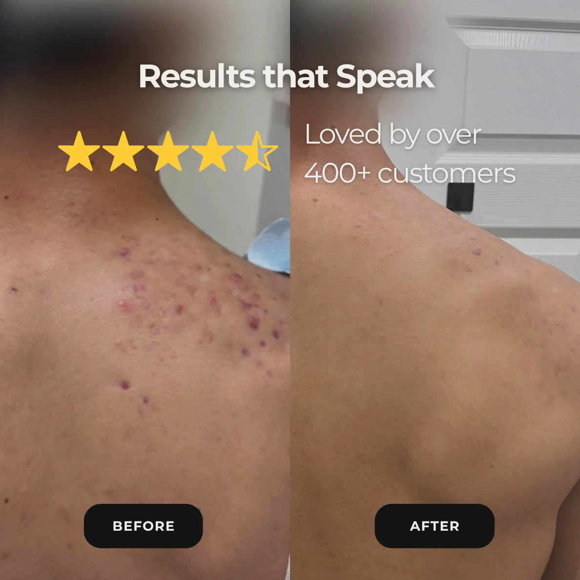 ✨ Cleaner, Healthier-Looking Skin in Just 30 Seconds
